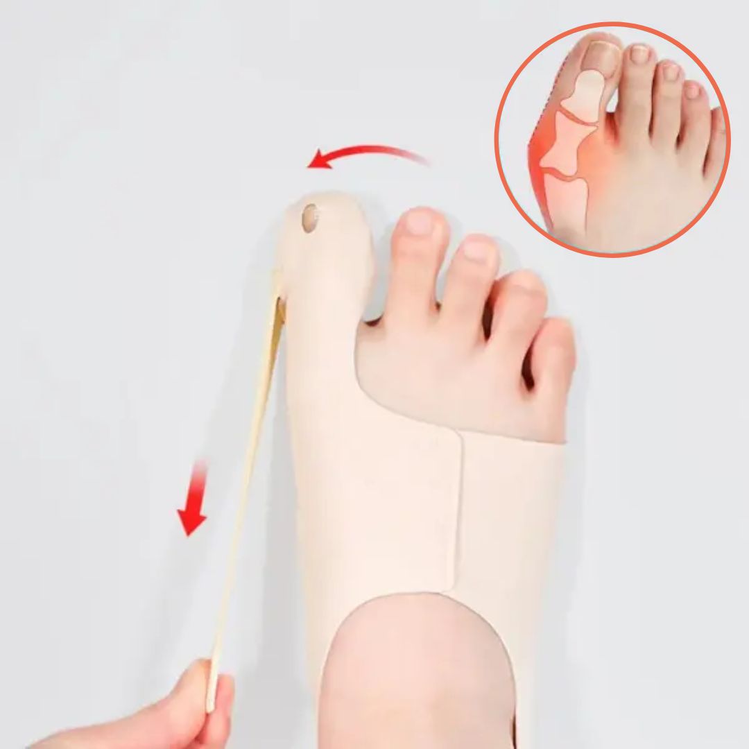 Hallux-Korrektor für schmerzfreie Bewegung
