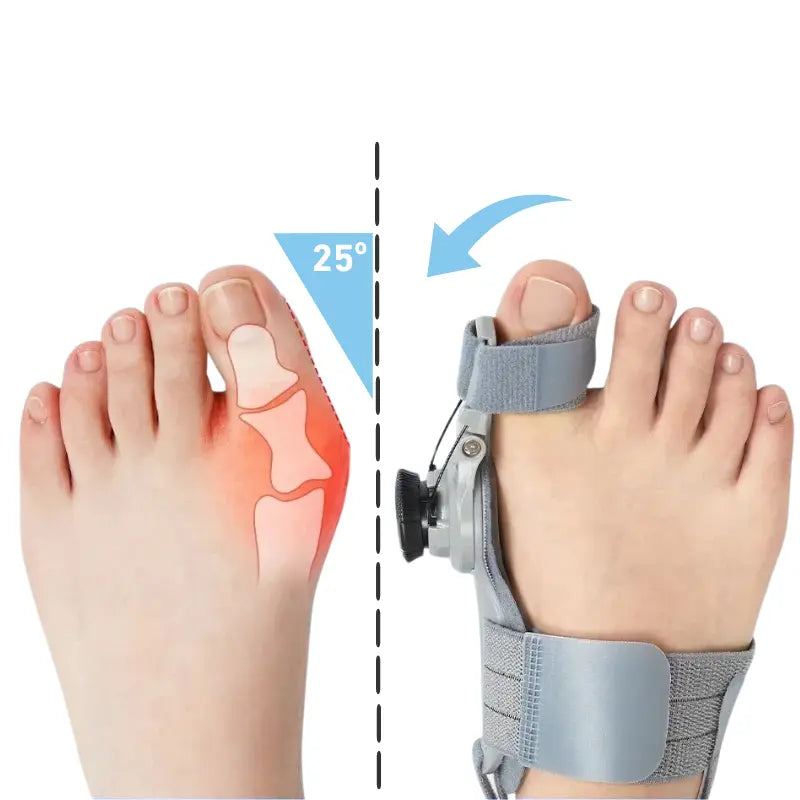 Hallux-valgus-Korrekturbandage