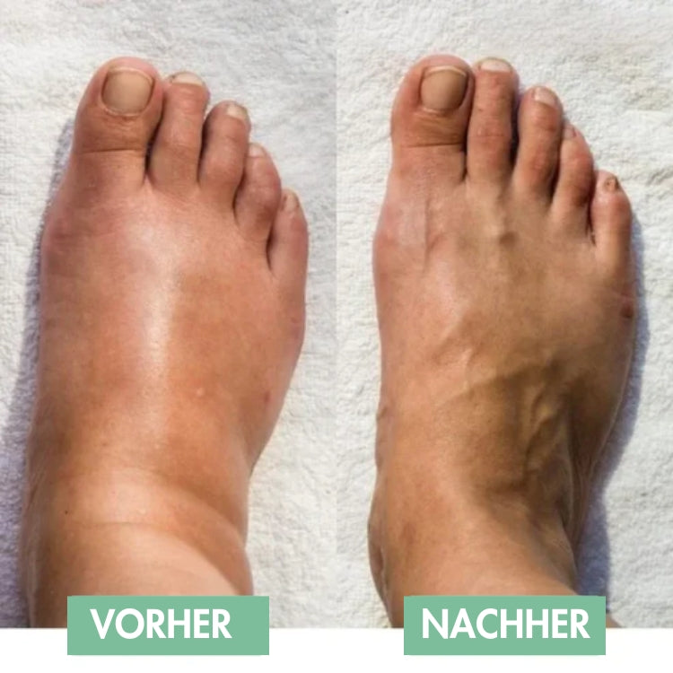 Innovatives EMS-Fußmassagegerät für sofortige Linderung