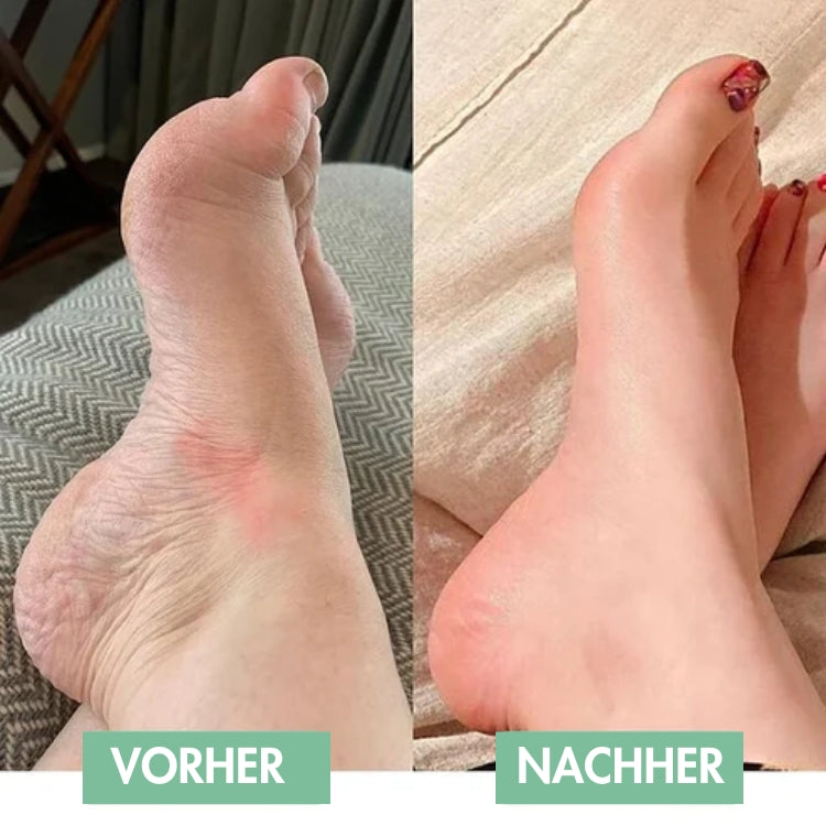 Innovatives EMS-Fußmassagegerät für sofortige Linderung