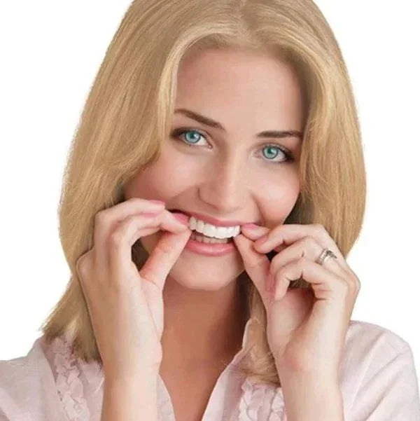 Snap-on-Smile-Veneers (Ober- und Unterkiefer)