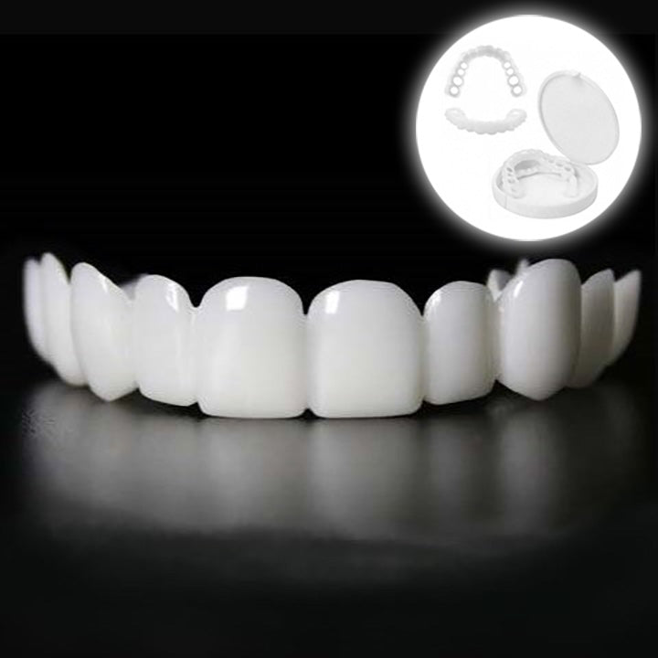 Snap-on-Smile-Veneers (Ober- und Unterkiefer)