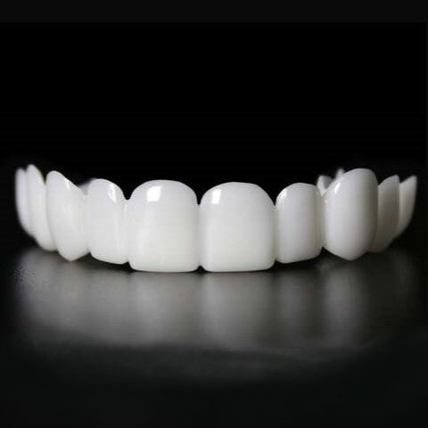 Snap-on-Smile-Veneers (Ober- und Unterkiefer)