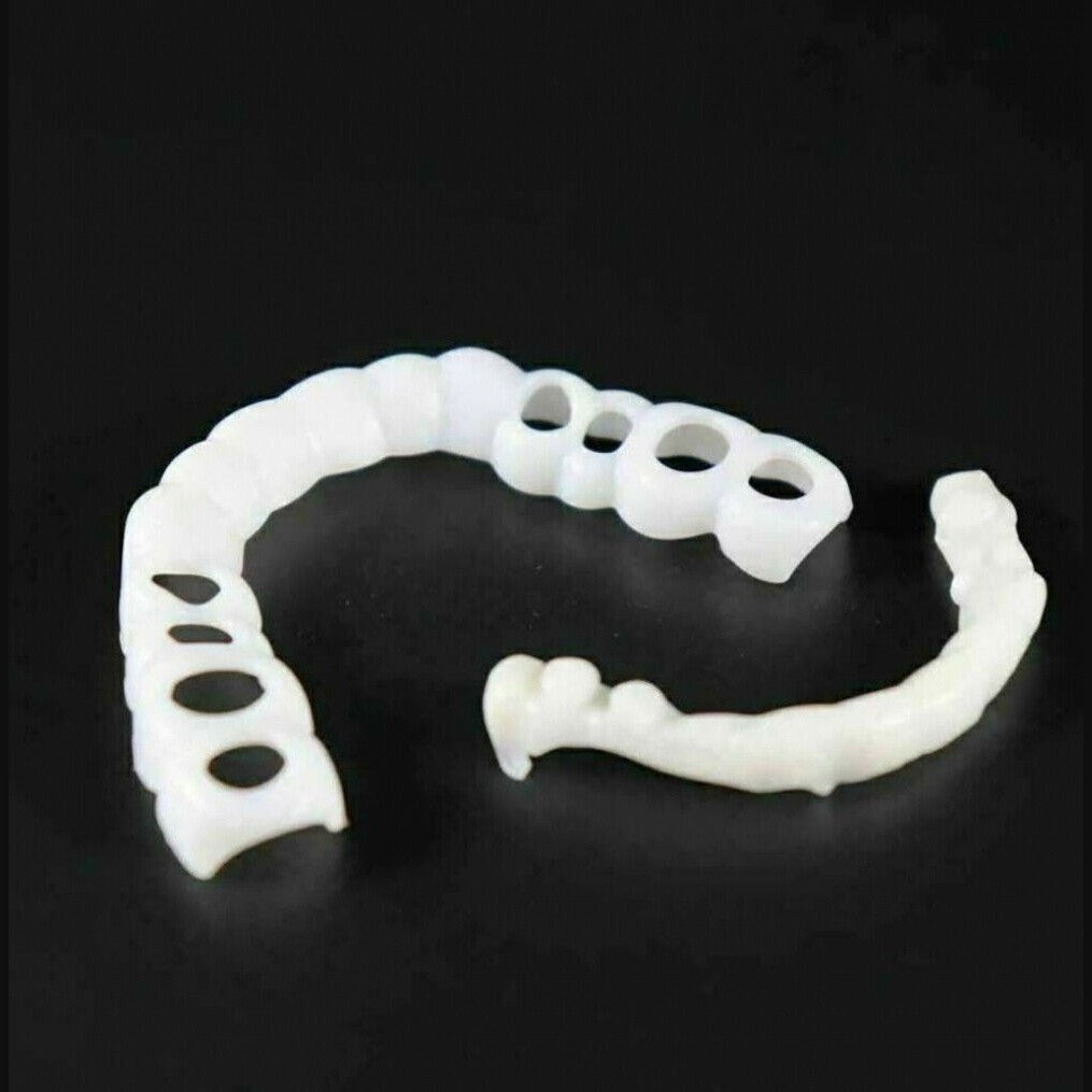 Snap-on-Smile-Veneers (Ober- und Unterkiefer)