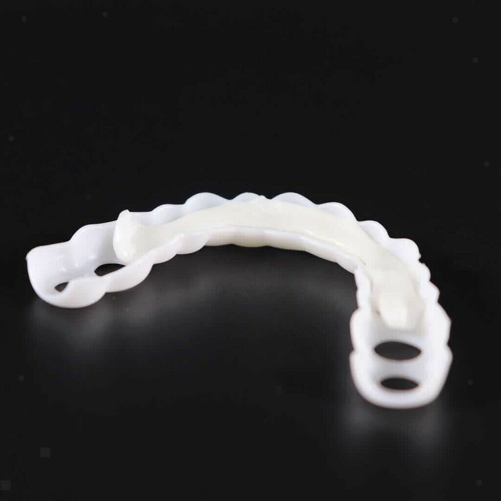 Snap-on-Smile-Veneers (Ober- und Unterkiefer)
