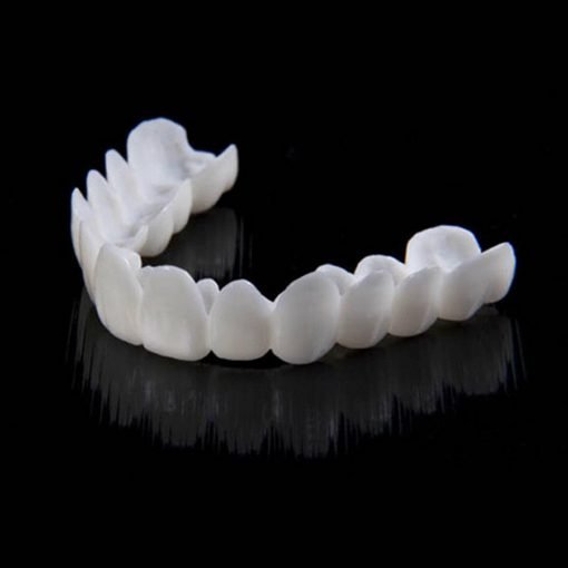 Snap-on-Smile-Veneers (Ober- und Unterkiefer)